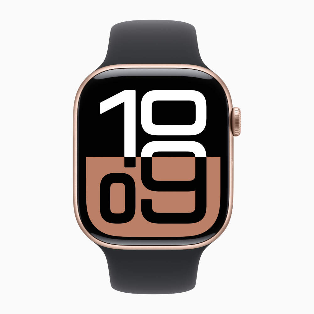 Oppo watch 41mm rose gold 2025